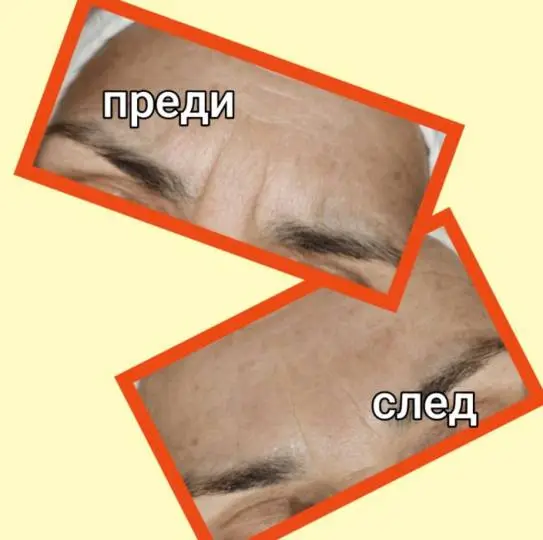 5D Матрично-жидкостные нити