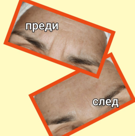 5Д Матрикс-Течни конци 