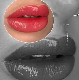 Full body laser hair removal