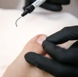 Medical pedicure at home