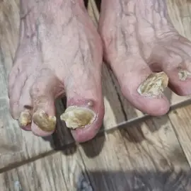 Module " Medical pedicure "