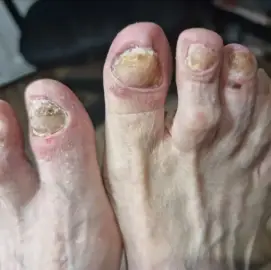 Module " Medical pedicure "