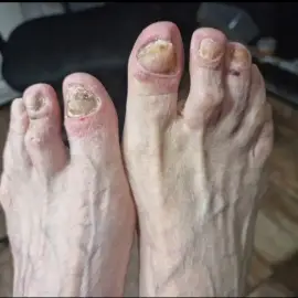 Module " Medical pedicure "