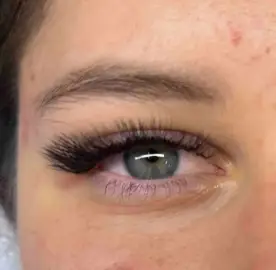 Migloplasty - American Style Salon