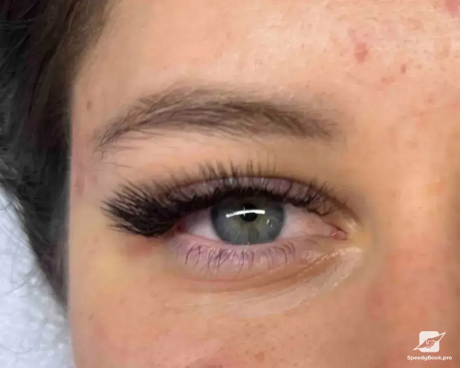 Migloplasty - American Style Salon